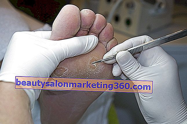 Fotvårdsspecialist som tar bort en callus från foten på kontoret