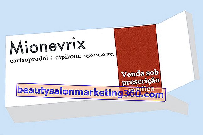 Mionevrix: izomfájdalom elleni gyógyszer