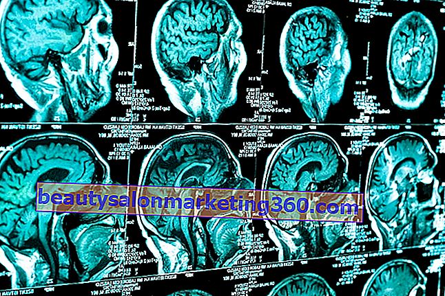 Mi a fej trauma, a fő tünetek és a kezelés