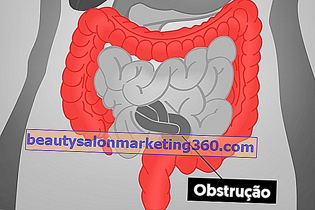 Ce este obstrucția intestinală, principalele simptome și tratament