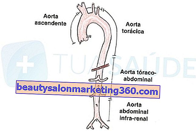 Arterija aorte