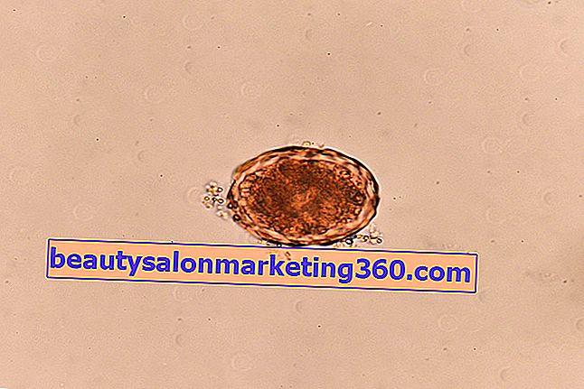Uovo di Ascaris lumbricoides