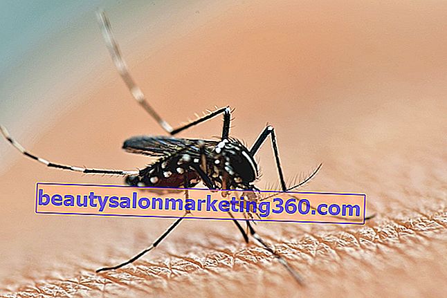 Principali complicanze della dengue