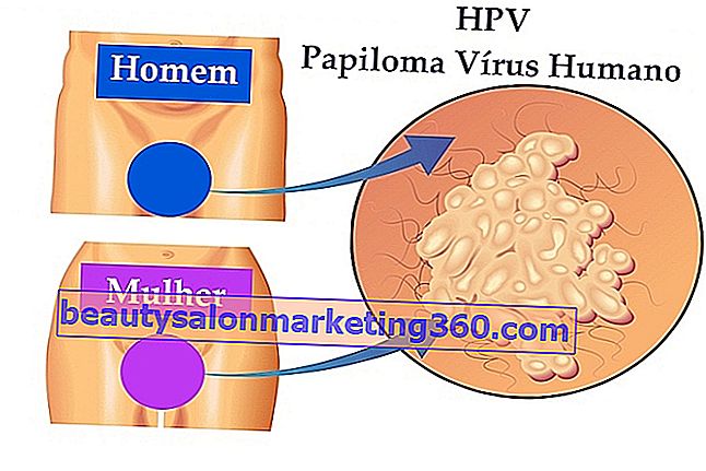 HPV-behandling - medicin og kirurgi