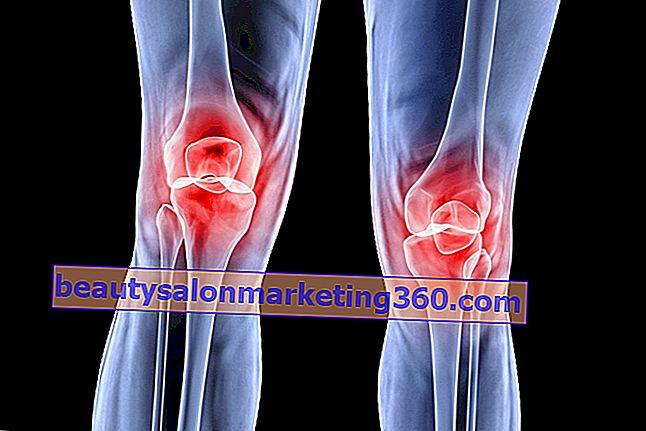 Bolovi ispred koljena mogu biti hondromalacija