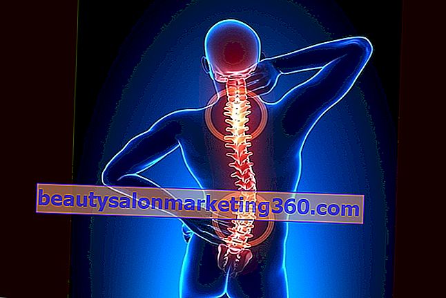Spinal artroz nasıl belirlenir ve tedavi edilir