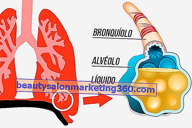 A tüdővíz fő tünetei, okai és kezelése