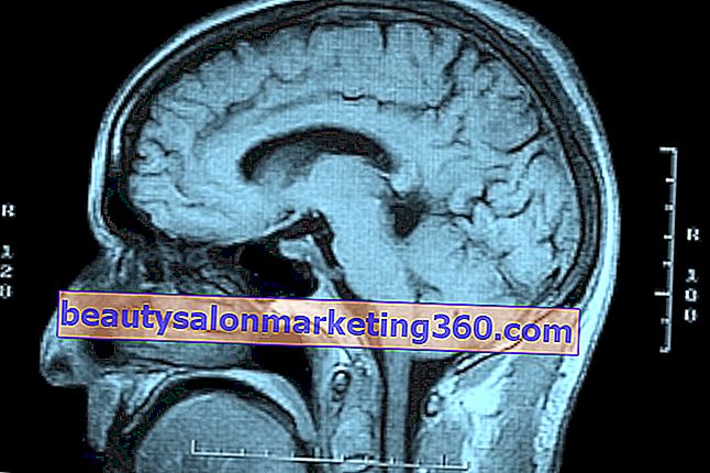 MRI-afbeelding van de schedel