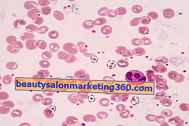 Razmaz krvi u kojem se vidljivo nazivaju trombociti