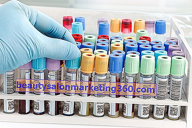 Blodfosfor test: hvordan det gøres og referenceværdier