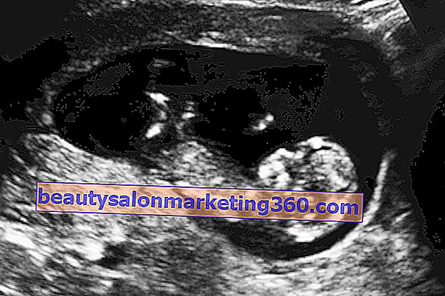 Razvoj bebe - 12 tjedana trudnoće