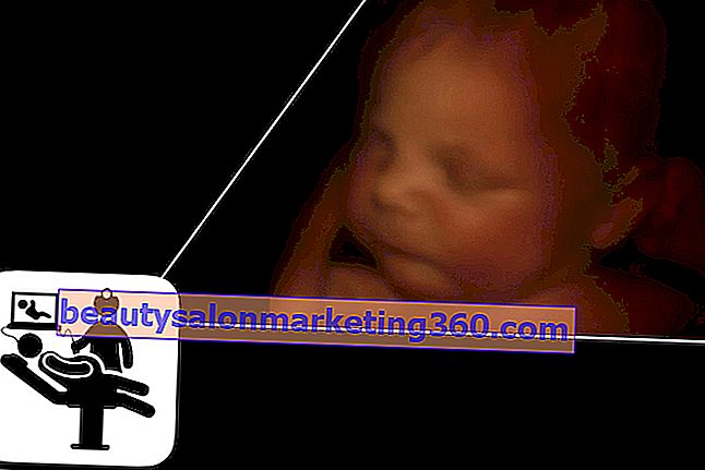 3D 초음파 아기 이미지