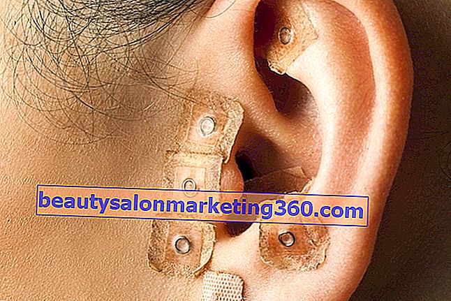 Agopuntura dell'orecchio