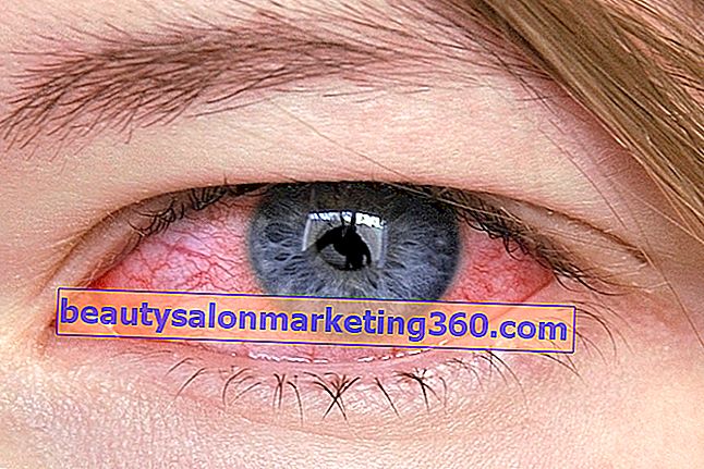 Očné kvapky na zápal spojiviek, lubrikačné, antialergické a protizápalové
