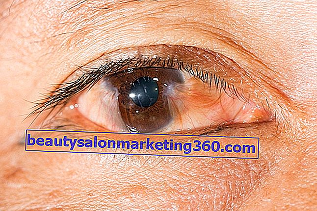 Žltá škvrna na oku: 3 hlavné príčiny a čo robiť