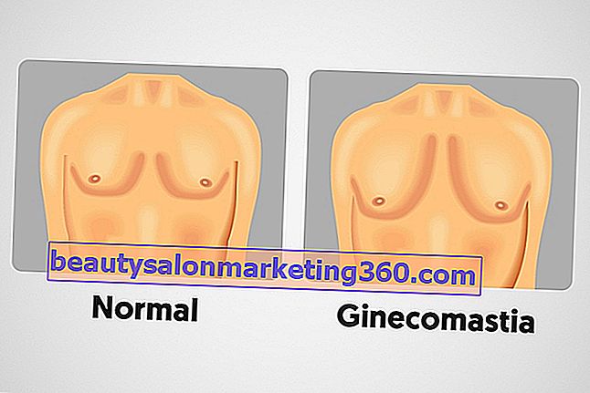 Hur man behandlar gynekomasti (bröstförstoring av män)