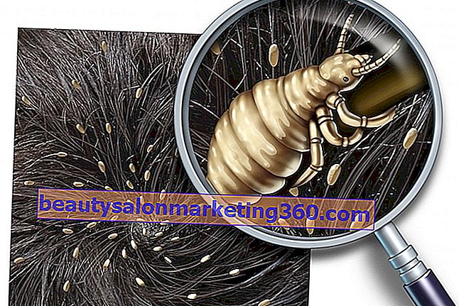 Cosa può essere formicolio nel cuoio capelluto e cosa fare